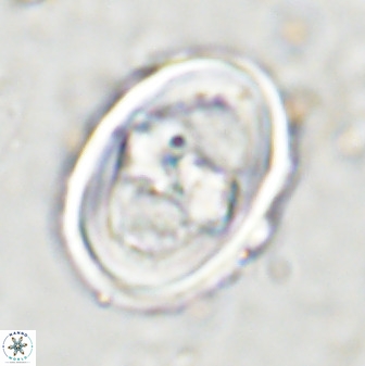 Gorkaea pseudanthophorus 36873