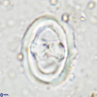 Gorkaea pseudanthophorus 36874