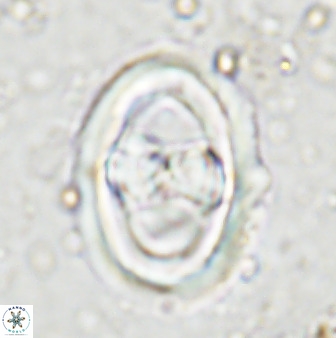 Gorkaea pseudanthophorus 36874