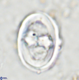 Gorkaea pseudanthophorus 36875