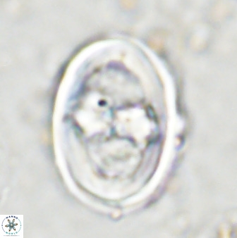 Gorkaea pseudanthophorus 36875