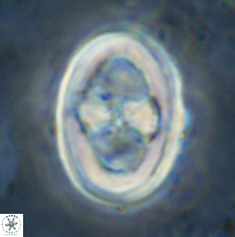 Gorkaea pseudanthophorus 36876