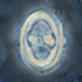Gorkaea pseudanthophorus 36877