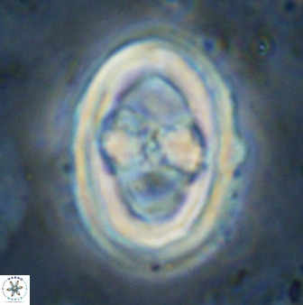 Gorkaea pseudanthophorus 36877