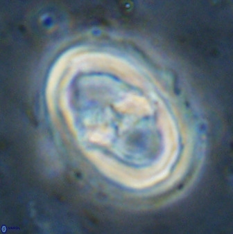 Gorkaea pseudanthophorus 36879
