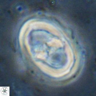 Gorkaea pseudanthophorus 36879