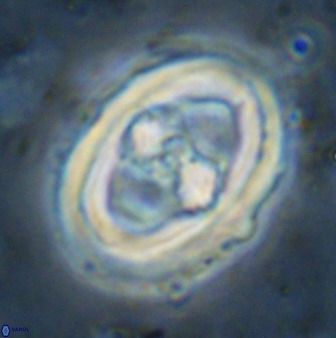 Gorkaea pseudanthophorus 36880
