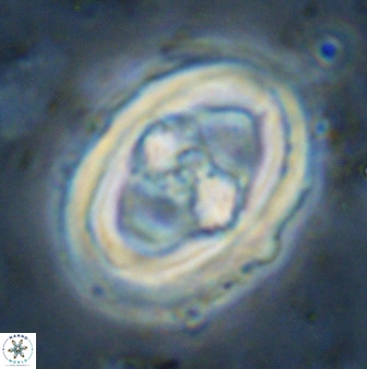 Gorkaea pseudanthophorus 36880