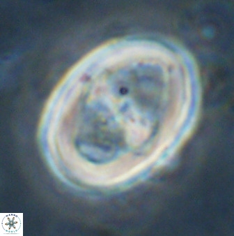 Gorkaea pseudanthophorus 36881