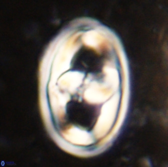 Gorkaea pseudanthophorus 38427