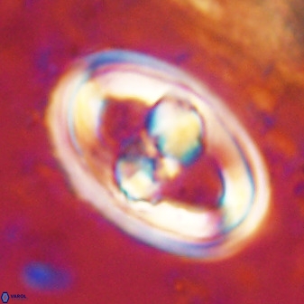 Gorkaea pseudanthophorus 38430