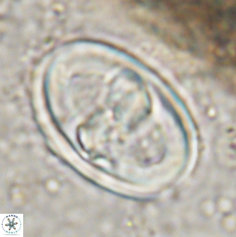 Gorkaea pseudanthophorus 38431