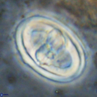 Gorkaea pseudanthophorus 38432