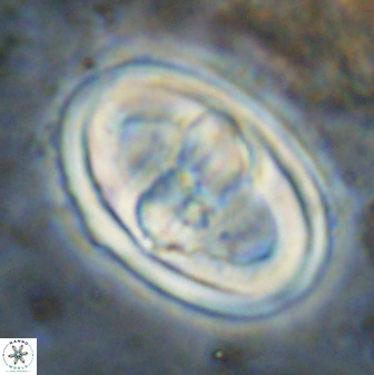 Gorkaea pseudanthophorus 38432