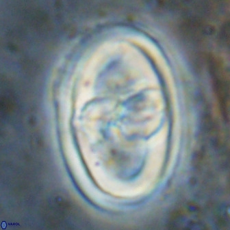 Gorkaea pseudanthophorus 38433