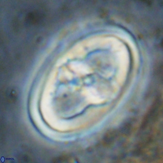 Gorkaea pseudanthophorus 38434