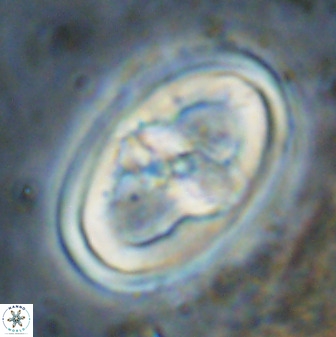 Gorkaea pseudanthophorus 38434