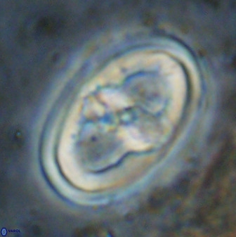 Gorkaea pseudanthophorus 38435