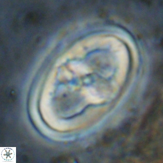 Gorkaea pseudanthophorus 38435