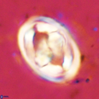 Gorkaea pseudanthophorus 48162