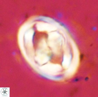 Gorkaea pseudanthophorus 48162