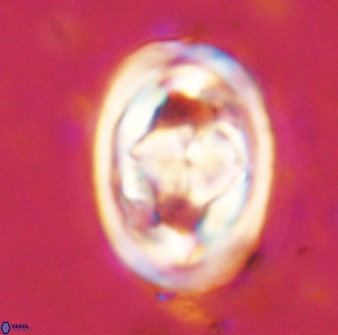 Gorkaea pseudanthophorus 48164