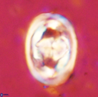 Gorkaea pseudanthophorus 48165