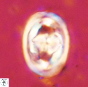 Gorkaea pseudanthophorus 48165