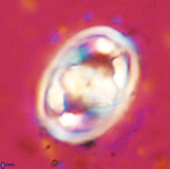 Gorkaea pseudanthophorus 48167