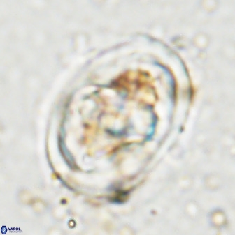 Gorkaea pseudanthophorus 48169