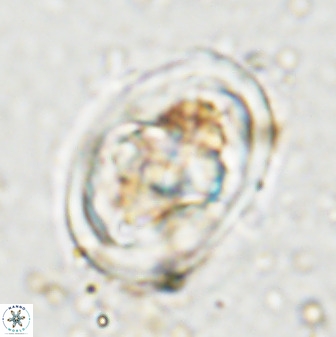 Gorkaea pseudanthophorus 48169