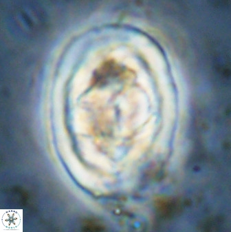 Gorkaea pseudanthophorus 48170