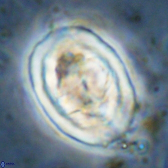 Gorkaea pseudanthophorus 48171