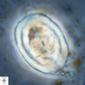 Gorkaea pseudanthophorus 48171