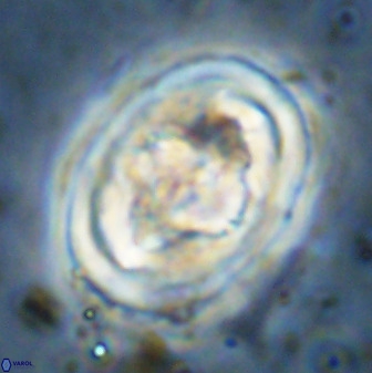 Gorkaea pseudanthophorus 48172