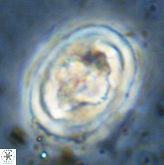 Gorkaea pseudanthophorus 48172