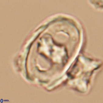Gorkaea pseudanthophorus 6389