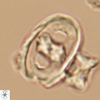 Gorkaea pseudanthophorus 6389