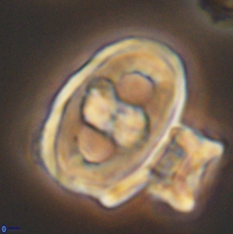 Gorkaea pseudanthophorus 6390