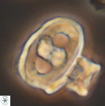 Gorkaea pseudanthophorus 6390