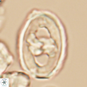 Gorkaea pseudanthophorus 6438