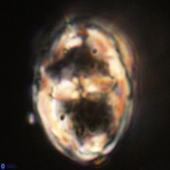 Gorkaea pseudanthophorus VR 22664