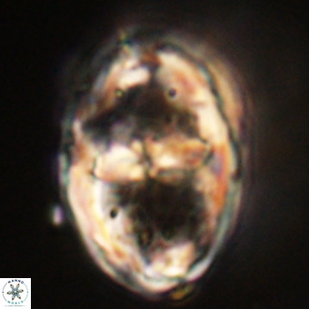 Gorkaea pseudanthophorus VR 22664