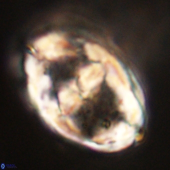 Gorkaea pseudanthophorus VR 22666