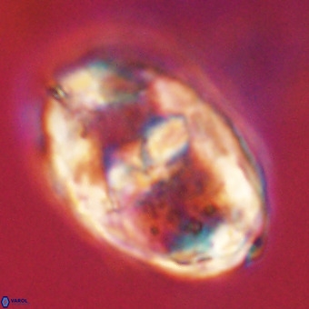 Gorkaea pseudanthophorus VR 22667
