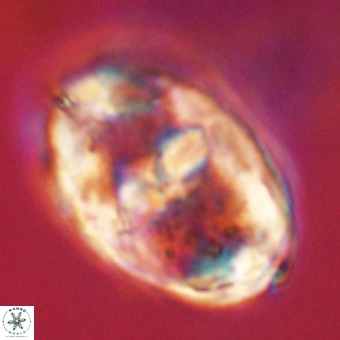 Gorkaea pseudanthophorus VR 22667