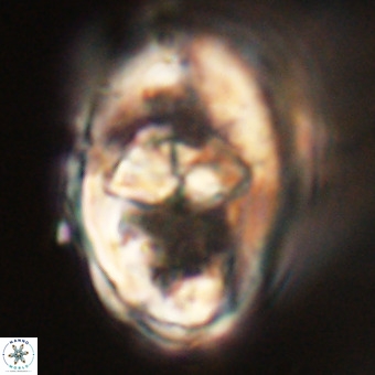 Gorkaea pseudanthophorus VR 22669