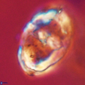 Gorkaea pseudanthophorus VR 22671