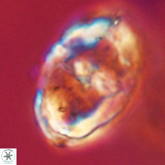 Gorkaea pseudanthophorus VR 22671