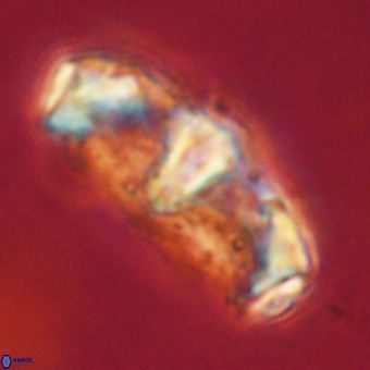 Gorkaea pseudanthophorus VR 22678